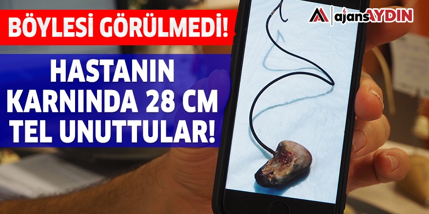HASTANIN KARNINDA 28 CM TEL UNUTTULAR